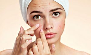 night cream for oily acne prone skin